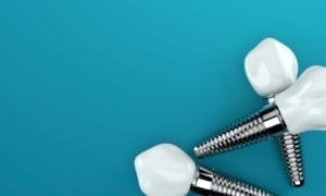 payette, idaho dental implants