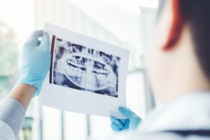 dental x-rays for routine preventative dentistry