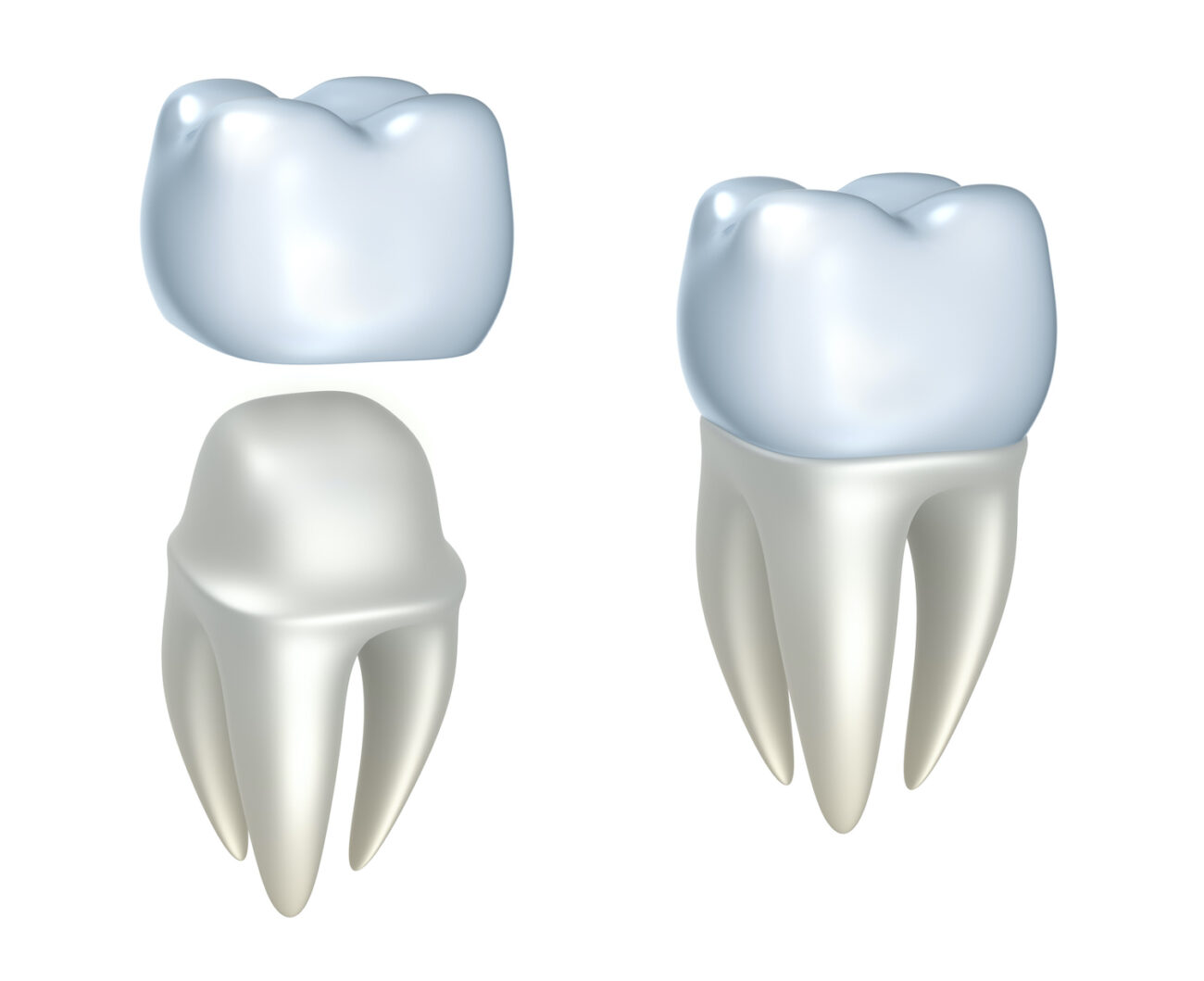 A dental crown could help protect and restore your tooth